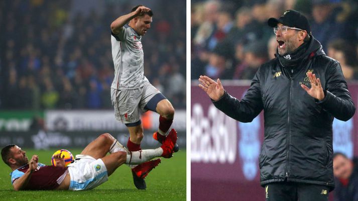 Jürgen Klopp og ein af tæklingum Burnley-manna í leiknum.