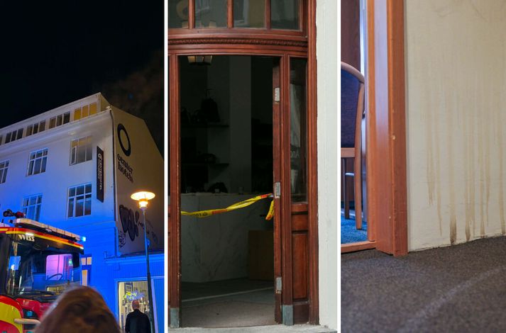 Mikið viðbragð var við hótelið í nótt vegna brunans. 