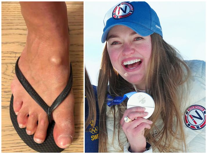 Thea Louise Stjernesund segist vera sárþjáð en harkaði af sér og vann Ólympíusilfur.