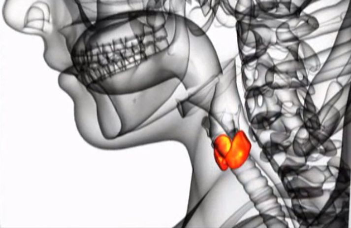 Skjaldkirtilshormónið, sem er misnotað, er T3-hormón sem er ekki algengt að notað sé til meðhöndlunar á vanvirkum skjaldkirtli nema með sérstakri undanþágu frá Lyfjastofnun.