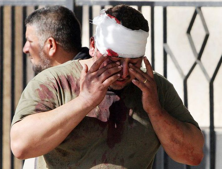 Slasaðist í Sprengingunni.  Veitingahúsið var fullt af fólki þegar sjálfsmorðssprengju­mennirnir tveir unnu illvirkið.