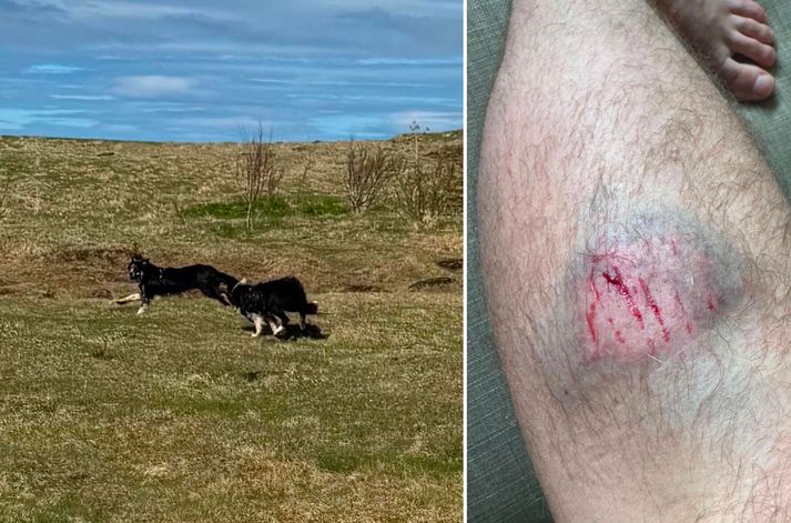 Maðurinn segir frá því að hann og vinkona sín hafi reynt að bakka varlega frá hundunum en þeir strax brugðist óðir við.