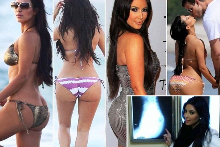 Kim Kardashian fór í röntgen með bakhlutann á sér til þess að sýna heiminum að engar ígræðslur væru þar að finna.