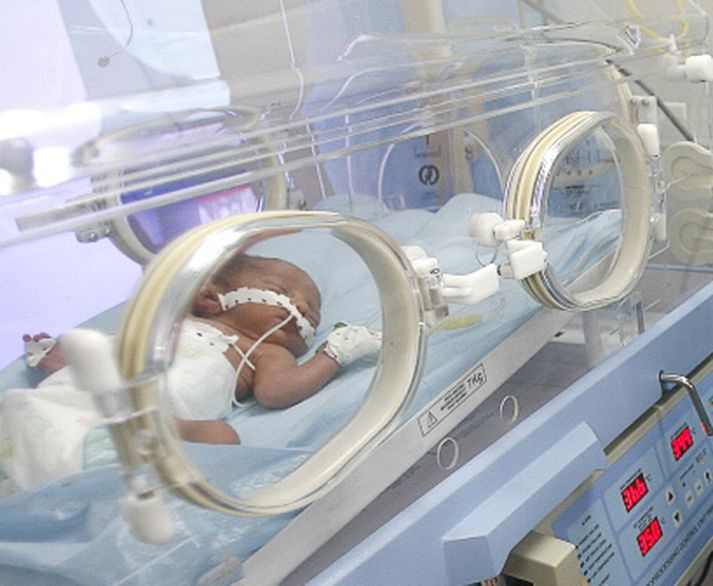 Barn í hitakassa eftir fæðingu. Mynd/ AFP.