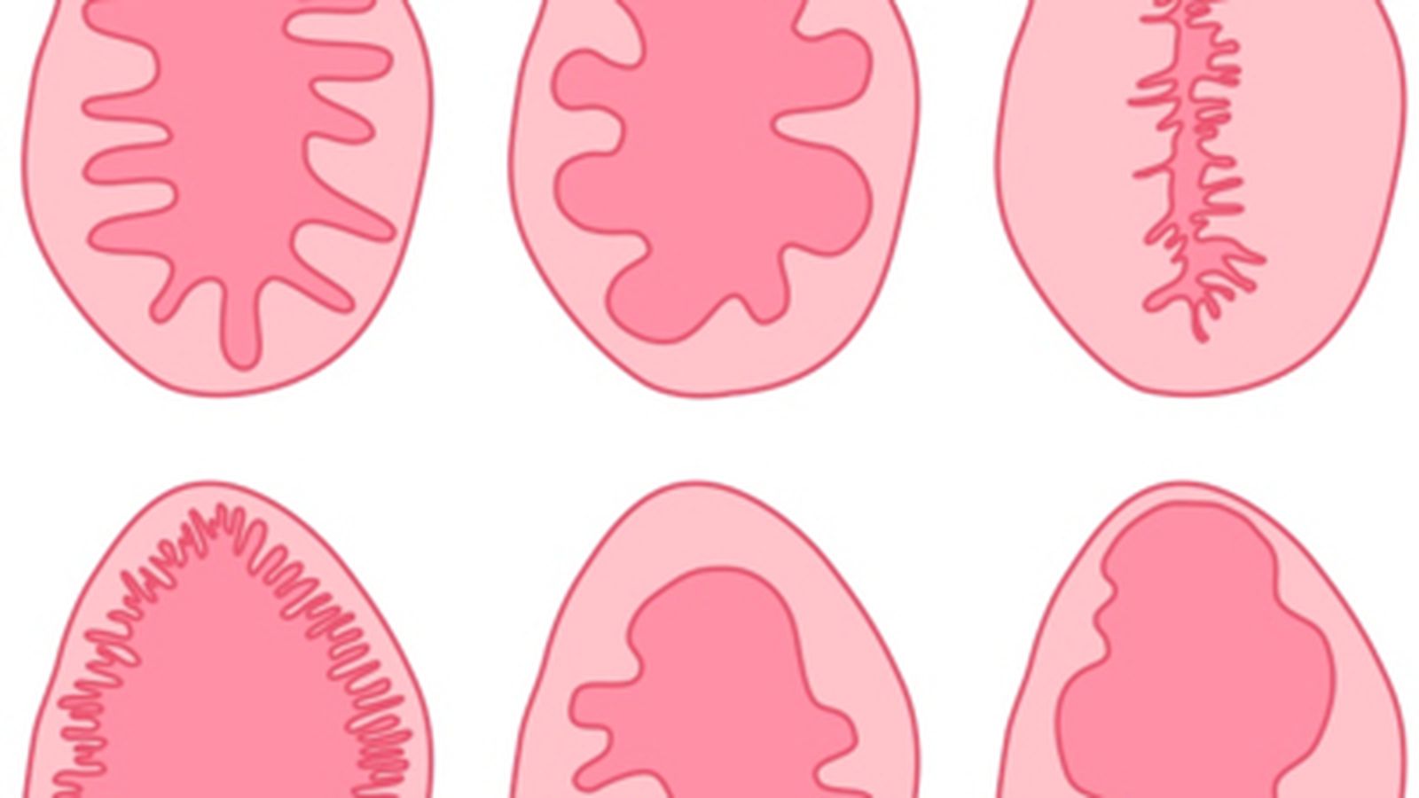 Hymen. Hymen. Hymen. Формы девственных плев. Разновидности девственности.