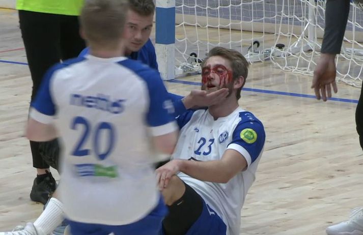 Blóðið fossar hér úr andliti ÍR-ingsins Úlfs Gunnars Kjartanssonar í leiknum á móti Val í Olís deild karla í handbolta.