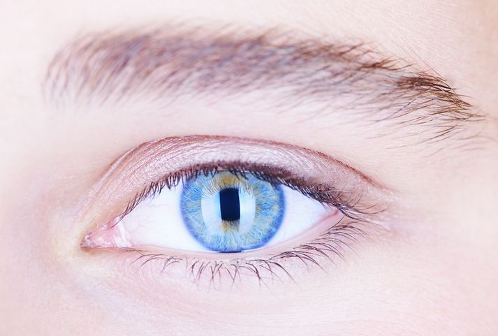 „Með þetta í huga vekur það mikla furðu að biðtími eftir jafn einfaldri aðgerð og augasteinsskiptum hér á landi nálgast nú hratt 3 ár.“