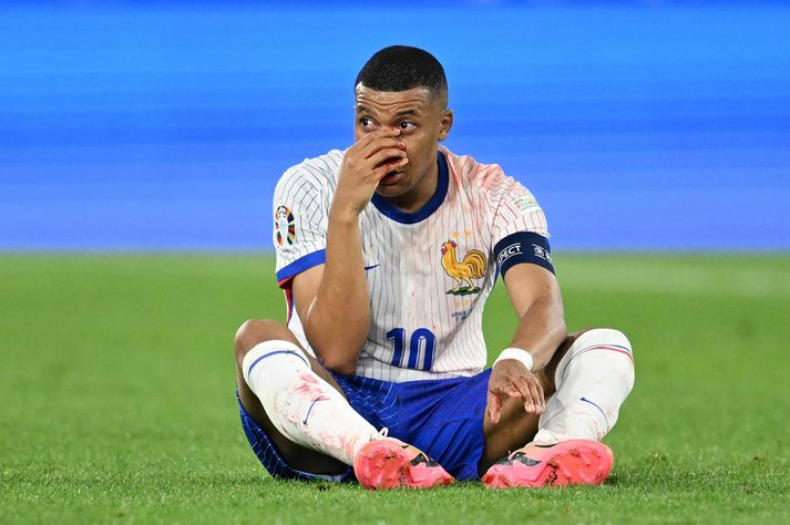 Kylian Mbappé sleppur við aðgerð eftir að hafa nefbrotnað, en þó er enn óvíst hvort hann geti verið með Frökkum er liðið mætir Hollendingum.