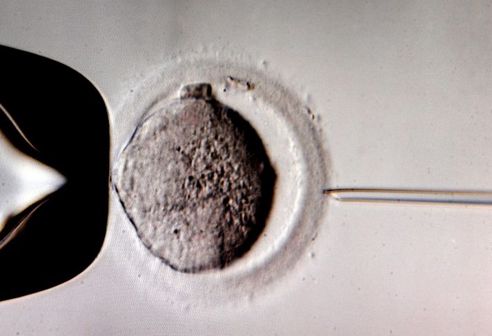 Crispr-erfðatæknin var notuð til að leiðrétta gallað gen í sæði sem var dælt í heilbrigt egg. Myndin er úr safni.