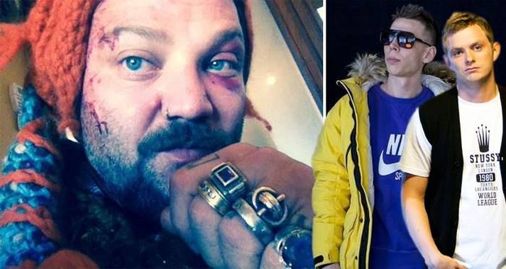 Bam Margera, til vinstri, ásamt röppurunum Gísla Pálma og Tiny.