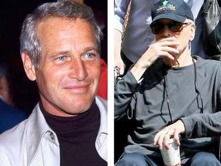 Paul Newman glímir við lungnakrabbamein.