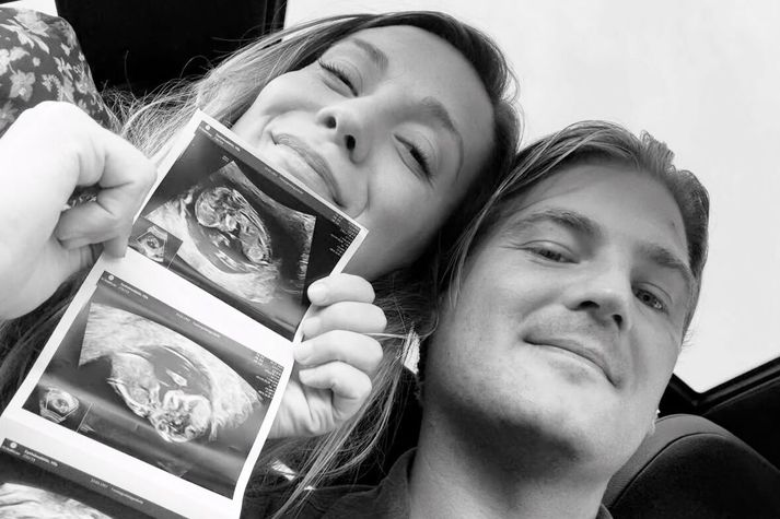 Ylfa Eysteinsdóttir og Viktor Weisshappel eiga von á barni.