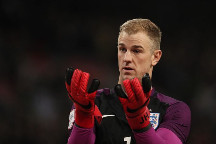 Joe Hart hefur ekki spilað vel upp á síðkastið.