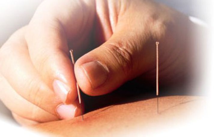 Umdeildar nálastungur.