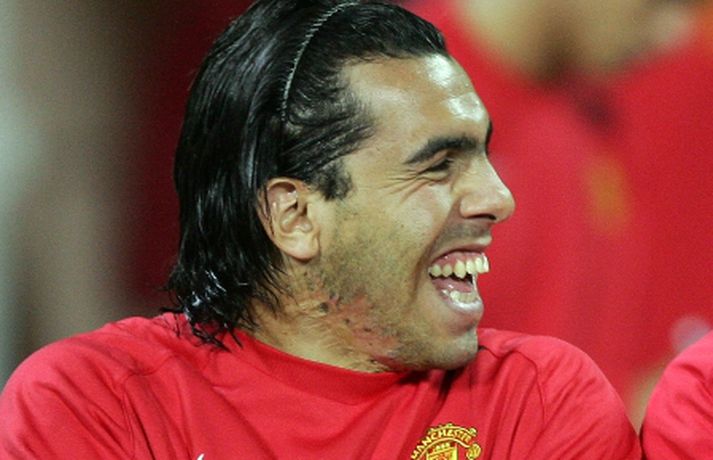 Tevez er stoltur af örunum