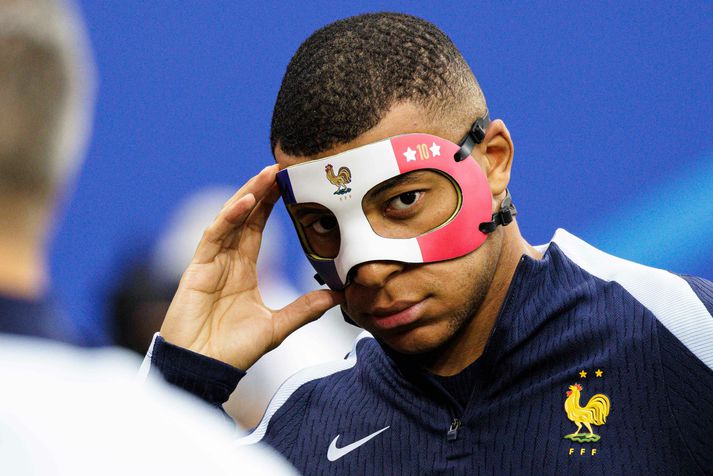 Kylian Mbappé nefbrotnaði í síðasta leik.