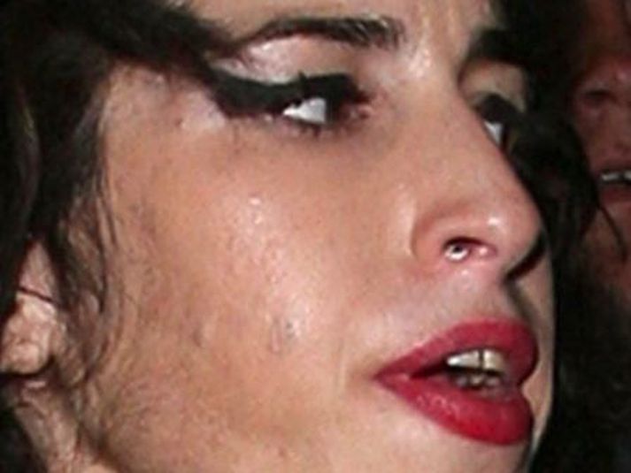 Amy Winehouse.