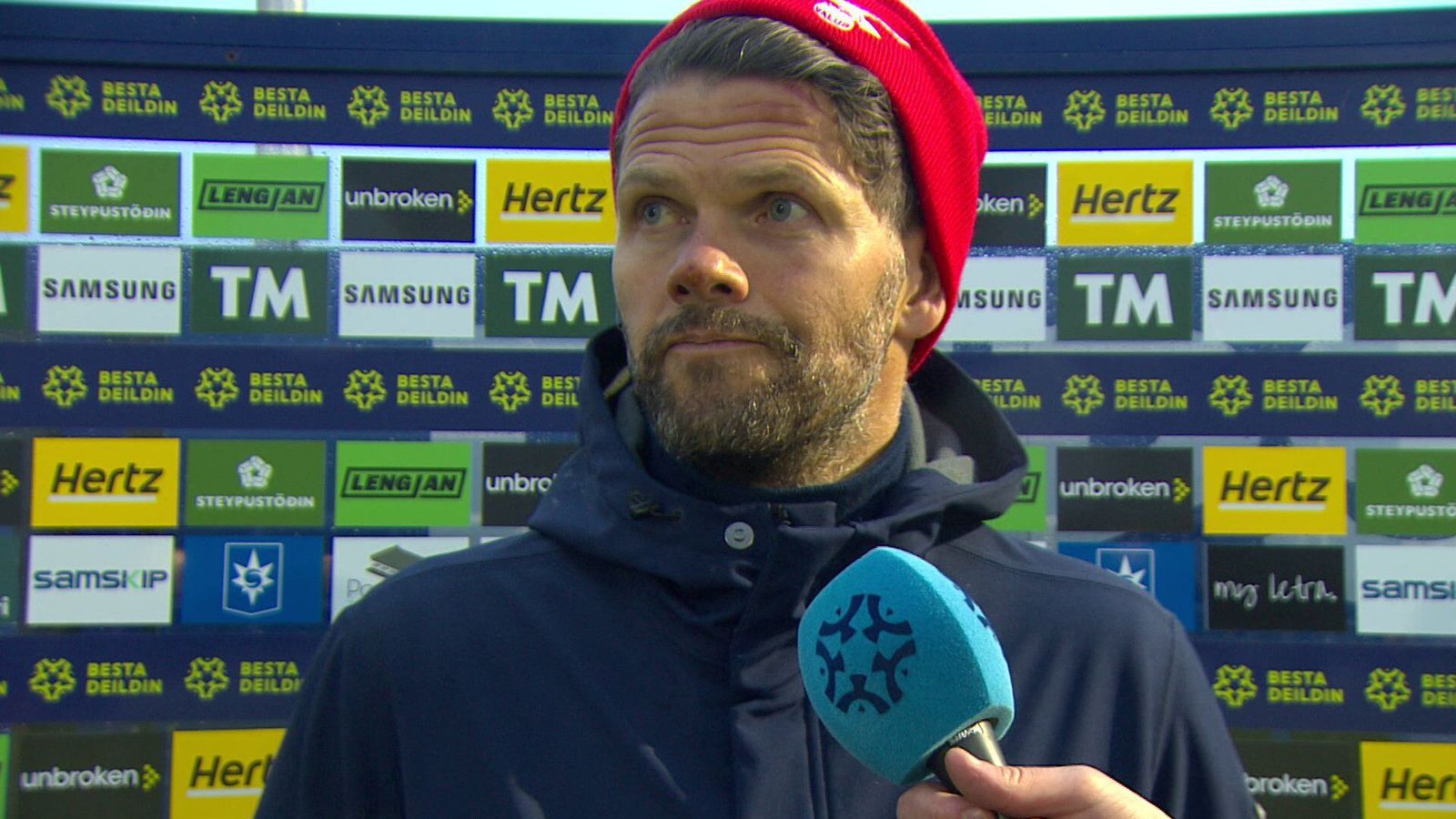 Skaðbrenndur Hemmi fer ekki aftur í eld­húsið