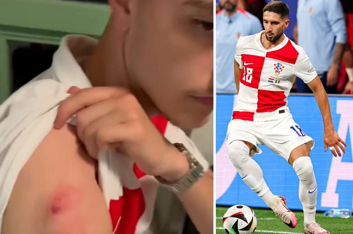 Lenard Barisic var bitinn þegar hann reyndi að fá treyju Lukas Ivanusec eftir leik Króatíu og Ítalíu.