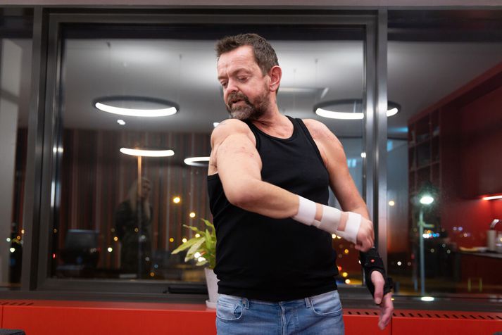 Guðmundur Felix Grétarsson lenti í slysi árið 1998 sem endaði með því að hann missti báða handleggi. Árið 2021 fékk hann svo grædda á sig nýja handleggi. 