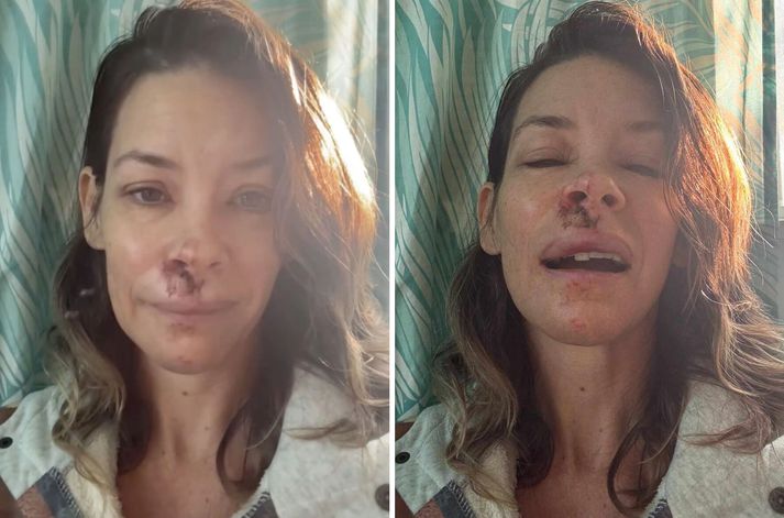 Evangeline Lilly lenti í hræðilegu slysi í maílok 2025 og er enn að jafna sig eftir heilaskaðann.