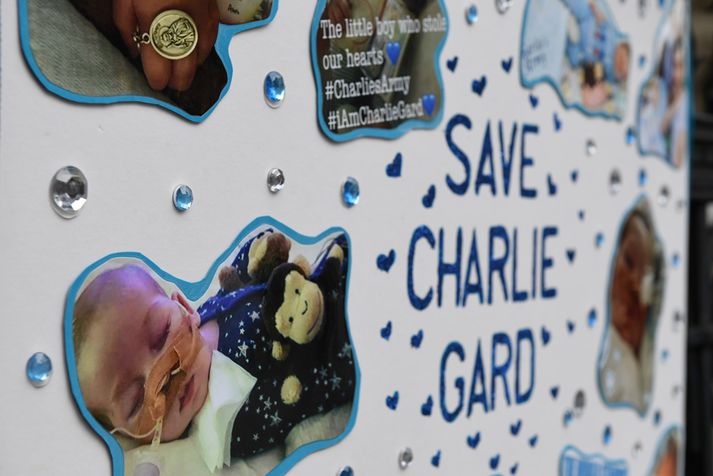 Charlie Gard þjáðist af afar sjaldgæfum og bannvænum hrörnunarsjúkdómi.