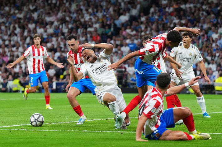 Mbappé fékk olnboga í andlitið. 