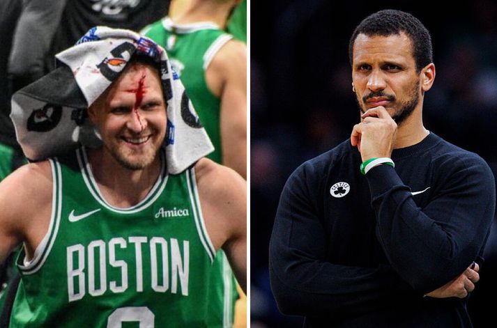 Kristaps Porzingis fékk stóran skurð á ennið en kann að höndla slíkt eins og þjálfari hans Jo Mazzulla talaði um eftir leik.
