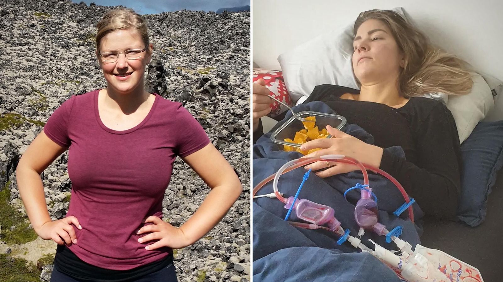 Enn með stútfulla eitla af iðnaðarsílíkoni