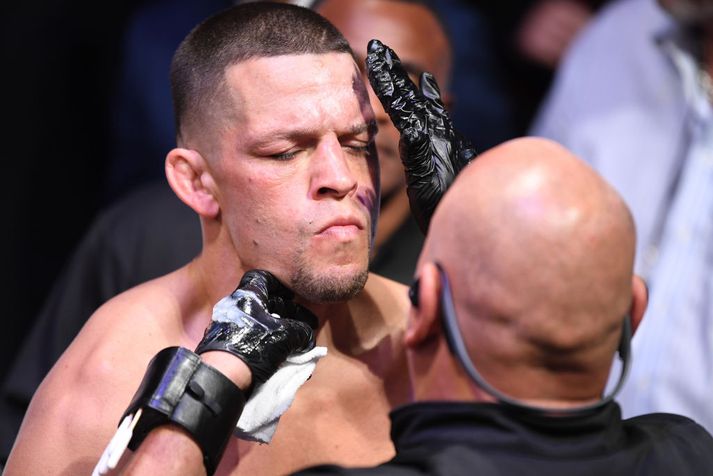 Nate Diaz.