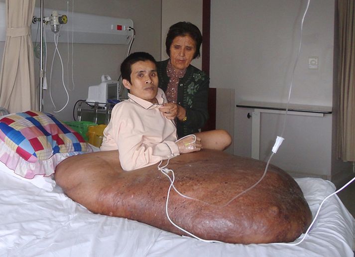 Nguyen Dyu Hai ásamt móður sinni.