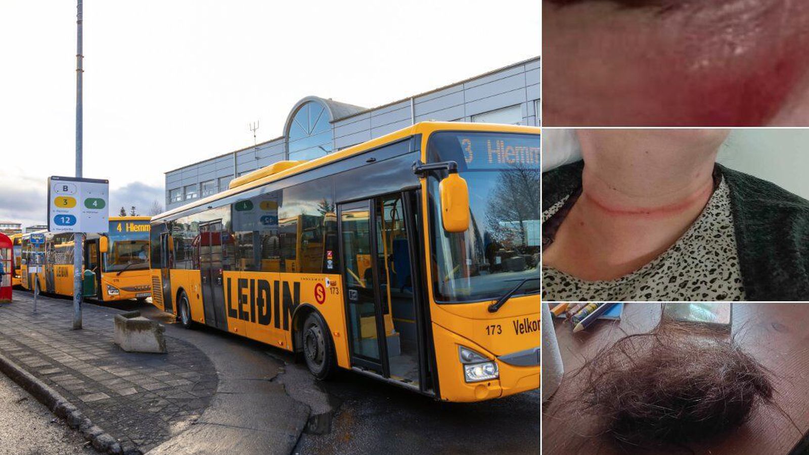 Ung­menni réðust að konu með höggum og spörkum í Mjóddinni
