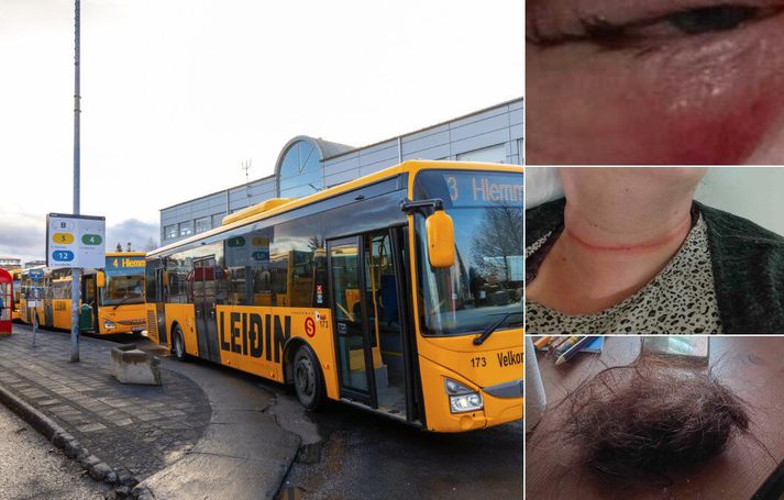 Atvikið átti sér stað á fimmtudag en veist var að konunni með höggum og spörkum. Lögreglan hefur undir höndum myndbönd af atvikinu og einnig frásagnir vitna. Konan er með áverka á andliti og þá var rifið í hár hennar líkt.