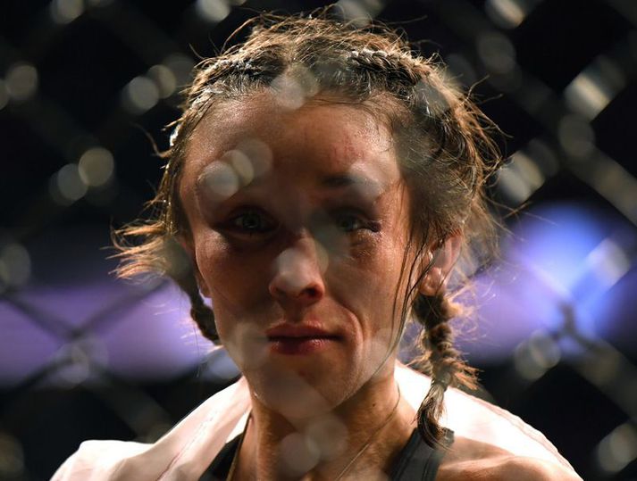 Joanna Jedrzejczyk kláraði bardagann í Las Vegas en hún leit svakalega út eftir hann.