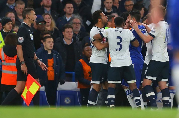 Costa heldur um andlitið eftir að Moussa Dembele potaði í auga hans.