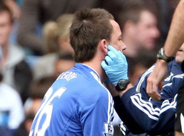 John Terry gæti verið úr leik næstu vikurnar