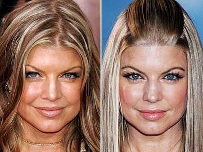 Varir og andlitslögun Fergie hafa auðsjáanlega breyst í tímans rás.