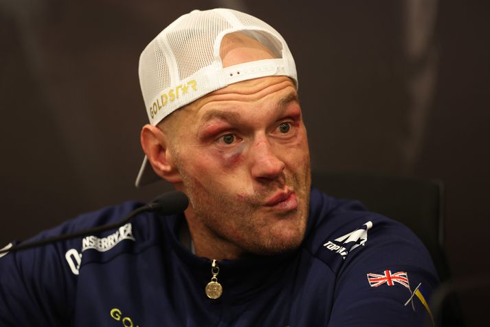 Tyson Fury var ekki sáttur eftir tapið fyrir Oleksandr Usyk og talaði um eina heimskulegustu ákvörðun í sögu hnefaleikanna.