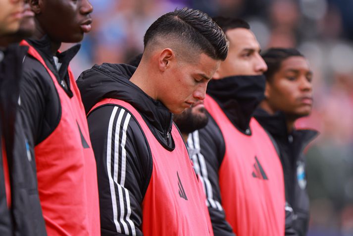 James Rodriguez þurfti að fara á sjúkrahús eftir landsleik Kólumbiumanna á dögunum. Liðið var að undirbúa sig fyrir HM í fótbolta i sumar.