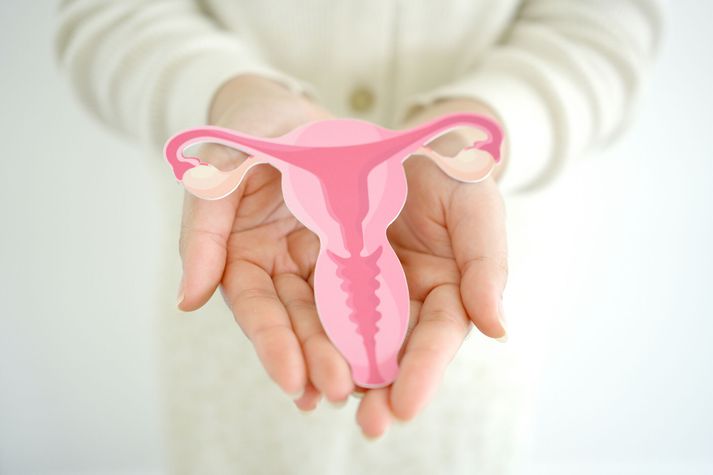 Talið er að ein af hverjum átta til tíu konum sé með PCOS, margar án þess að vita það.