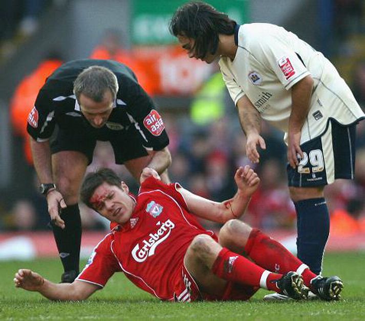 Liverpool lá fyrir Barnsley.