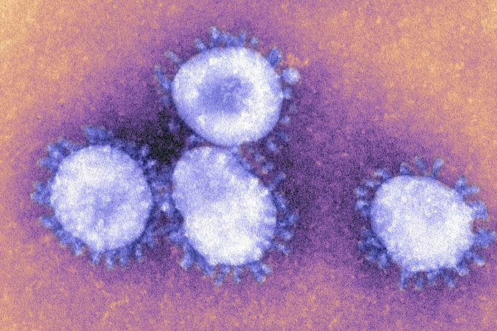 Coronavirus, Tem