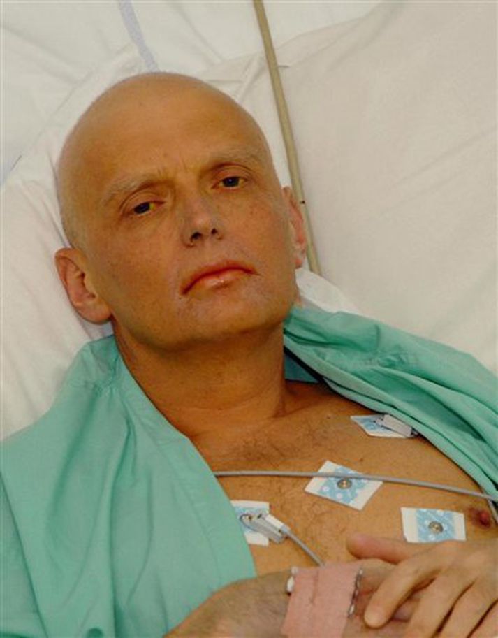 Myndir af Litvinenko sem birtar voru í gær sýna að hann er illa haldinn vegna talíumeitrunar.