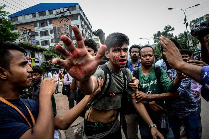 Nokkrir mótmælendur særðust í aðgerðum lögreglu í Dhaka, höfuðborg Bangladess, í dag.