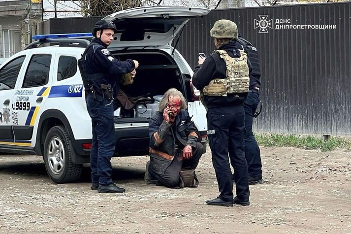 Særður íbúi í Kryvyi Rih í Úkraínu eftir eldflaugaárás Rússa á miðvikudag.