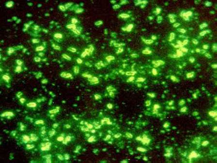 Yersinia pestis er talin vera orsök Svarta dauða.