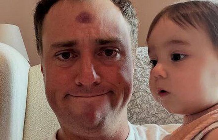 Justin Thomas með dóttur sína Molly en það stórsér á honum.