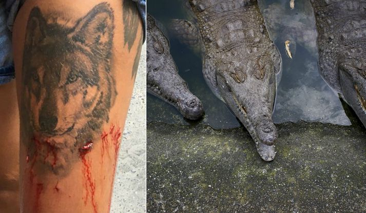 Konan fór á sjúkrahús þar sem hlúð var að sárum hennar.