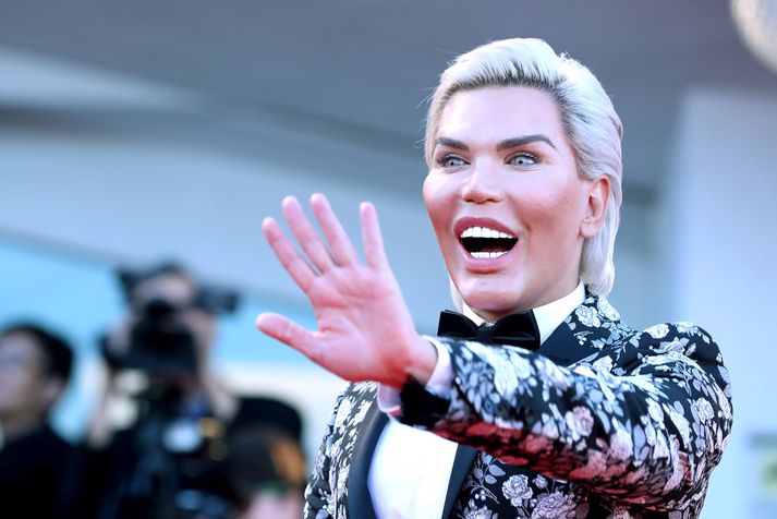 Rodrigo Alves hefur gengist undir fjölmargar lýtaaðgerðir til að fullkomna útlitið.