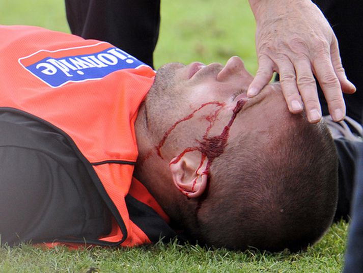 Matthew Upson liggur hér á jörðinni eftir samstuðið við Jermain Defoe.